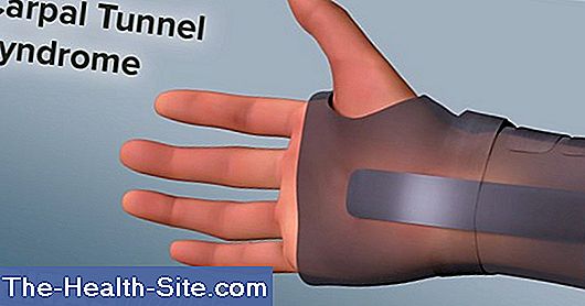 Tunnel syndrome