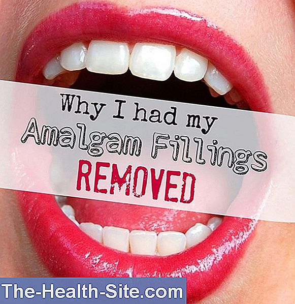 Amalgam Problems 💊 ScientificPractical Medical Journal 2024