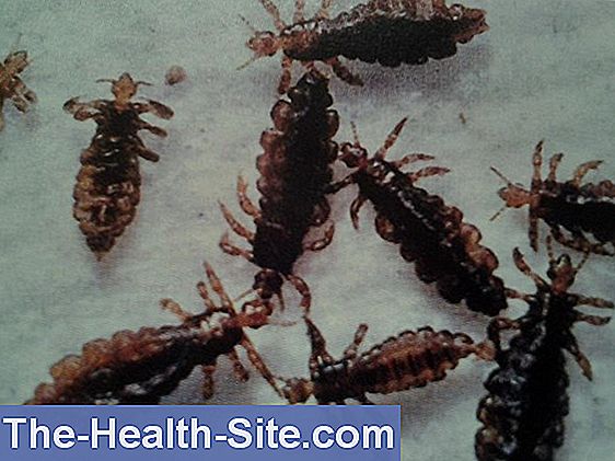 treat-head-lice-at-no-cost-on-prescription-lice-scientific