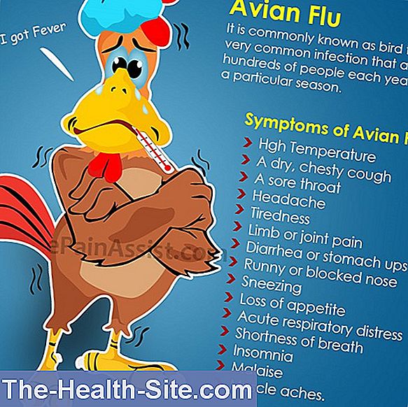 Avian Flu 💊 ScientificPractical Medical Journal 2024