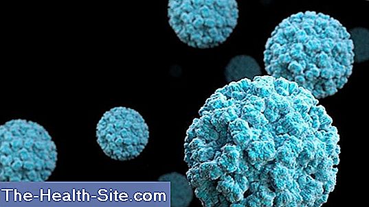 Infection norovirus