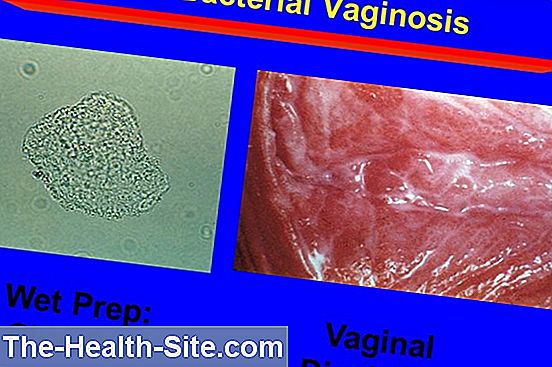 bacterium infection vaginal Euro trash porn