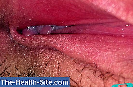 picture of vaginal yeast infection Clip gratos porno