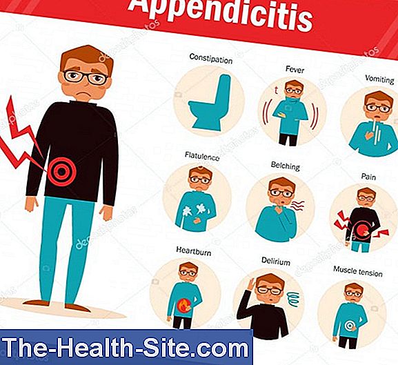 Appendicit